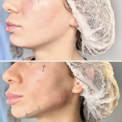 Medical Aesthetic Katerina Thomaidou - Gdynia, Medycyna Estetyczna, Szkolenia